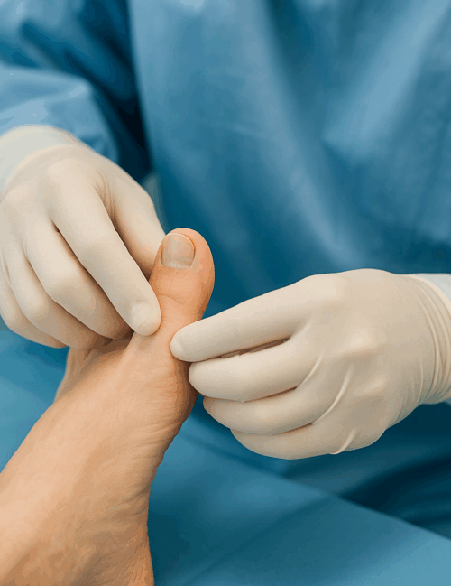 تصحيح تشوهات أصابع