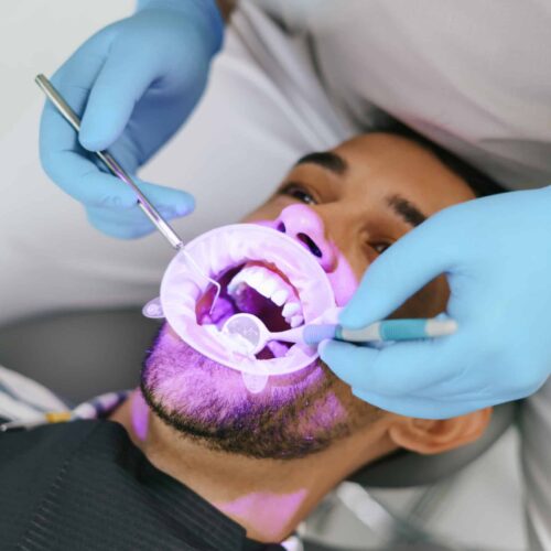 Young man with patient bib on a dental chair, pink light oriented on his teeth and a dentist who sits next to him wearing blue medical gloves while examining oral cavity