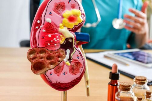 A selective focus of a doctor and a kidney model with small bottles of medicine and oils.