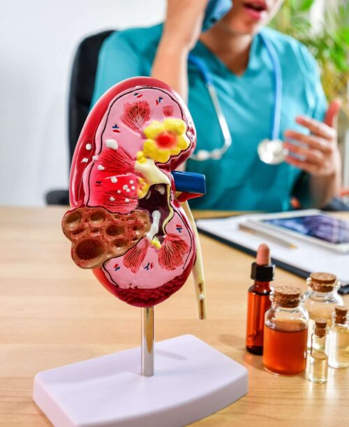 A selective focus of a doctor and a kidney model with small bottles of medicine and oils.