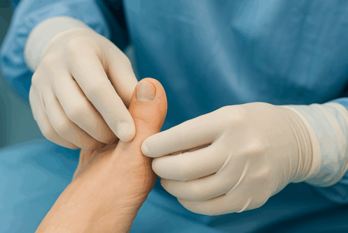 Toe or Foot Deformity Corrections in Sharjah